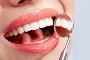 Effingham teeth whitening image
